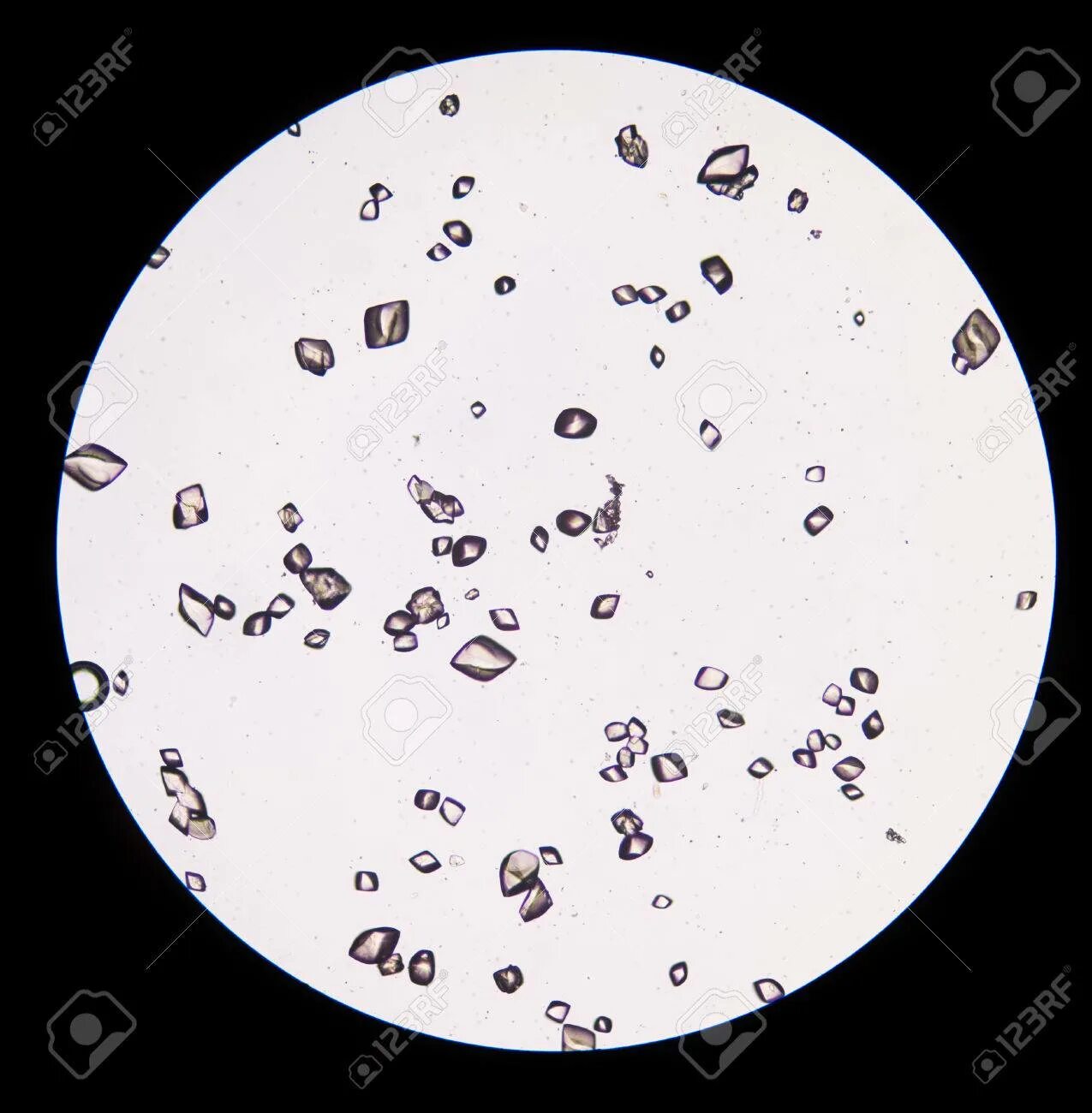 Кристаллы оксалата в моче у мужчин. Микроскопия осадка мочи. Мелкие частички в моче. Соли в моче под микроскопом. Кристаллы в моче под микроскопом.