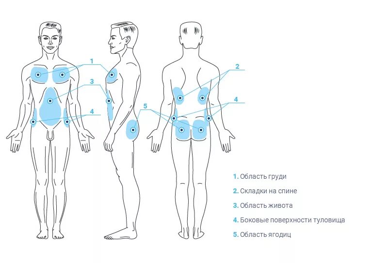 Мужские эрогенные зоны. Зоны для миостимуляции схема. Техника введения липолитиков схема. Схема уколов липолитиков. Схема наложения электродов миостимуляции позвоночника.
