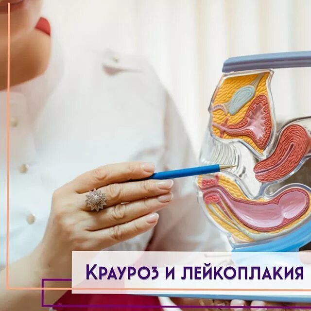 Крауроз и лейкоплакия вульвы. Крауроз эффективное лечение