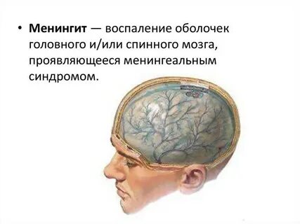 Мозг человека воспаление