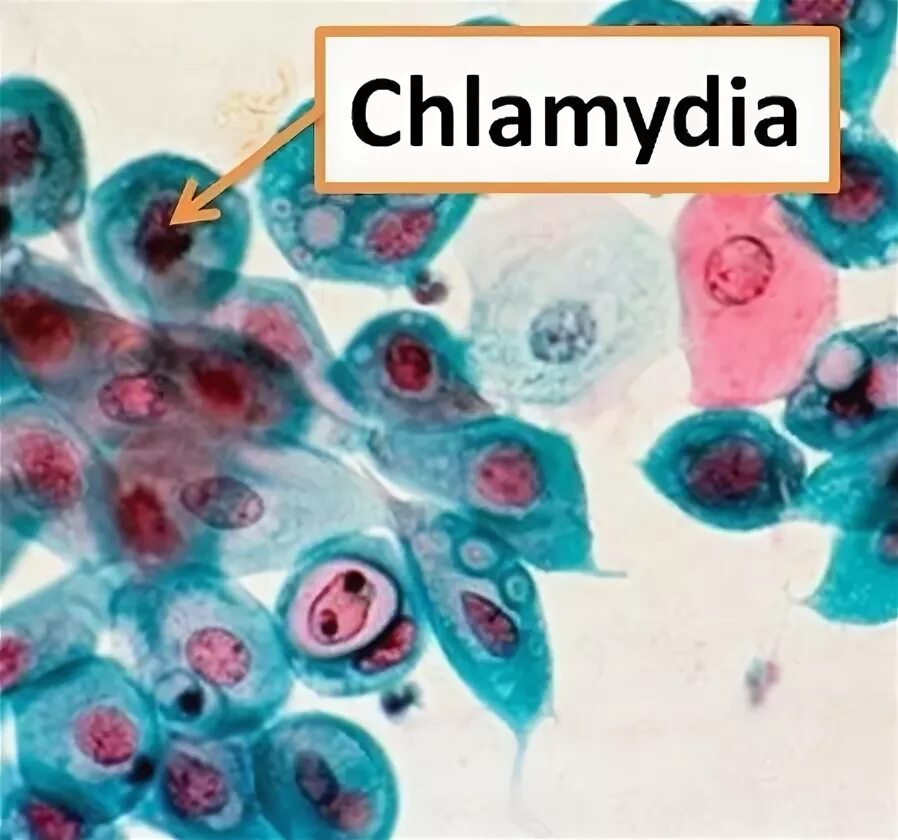 Chlamydia trachomatis mycoplasma genitalium