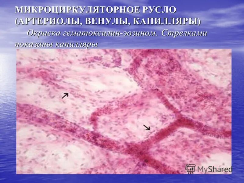 Сосуды микроциркуляторного русла схема. Микроциркуляторное русло функции. Сосуды микроциркуляторного русла строение ткани. Микроциркуляторное русло функции. Микроциркуляторное русло функции.