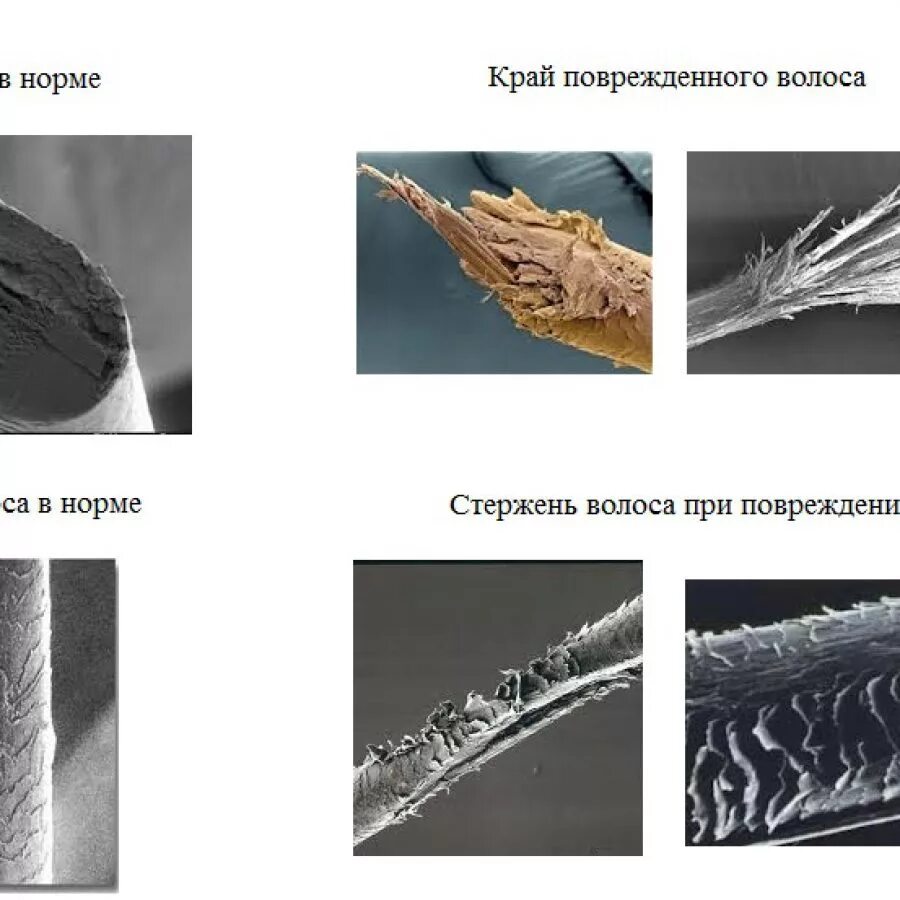 Поврежденный волос под микроскопом. Обесцвеченный волос под микроскопом. Поврежденная структура волос. Степени повреждения волос под микроскопом.