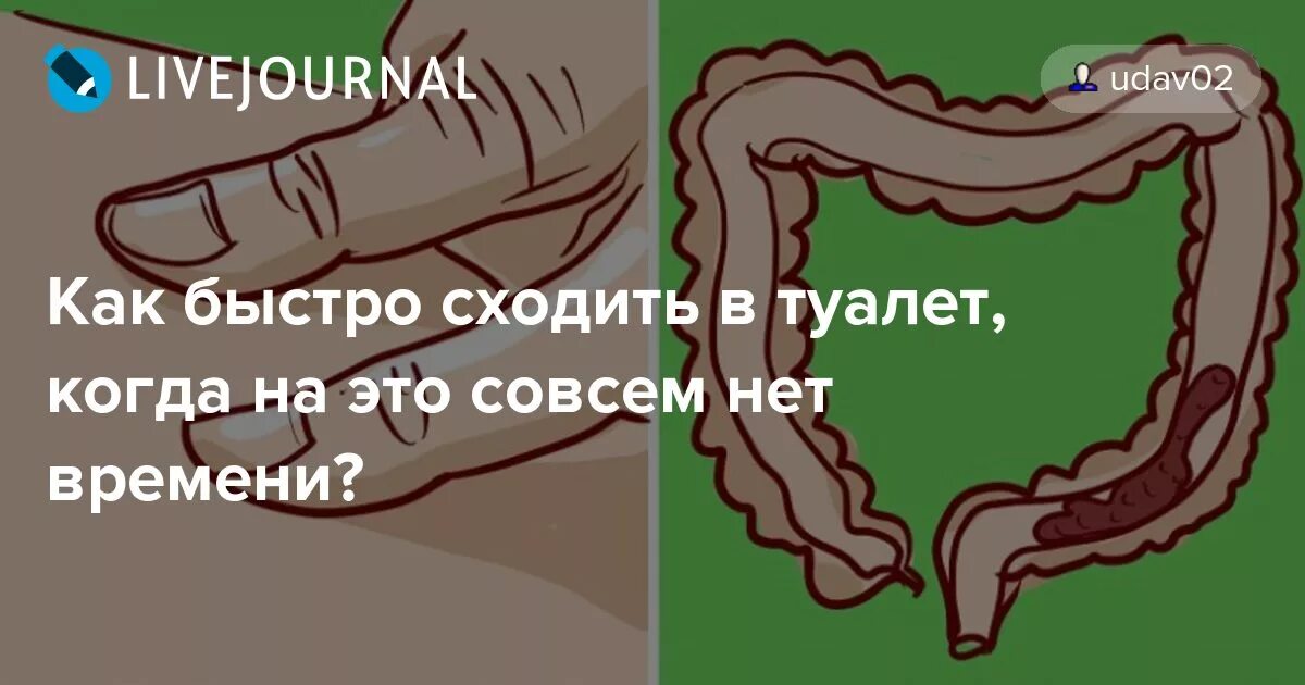 Как сходить в туалет по большому при запоре быстро. Упражнения для быстрого опорожнения кишечника. Упражнения чтоб сходить в туалет по большому быстро.