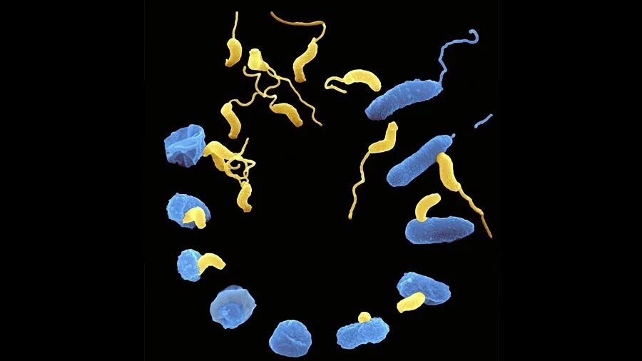 Bdellovibrio bacteriovorus. Вибрион монотрих Bdellovibrio bacteriovorus. Хищные бактерии. Бактерии хищники.