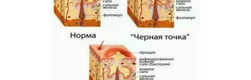 Что если из. Что если из