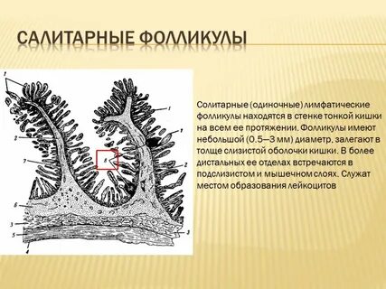 Пейеров бляшки