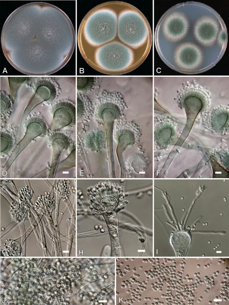 Мицелий аспергилла. Пеницилл и аспергилл. Микробиология Penicillium Aspergillus. Aspergillus fumigatus микроскоп. Грибы споры в организме