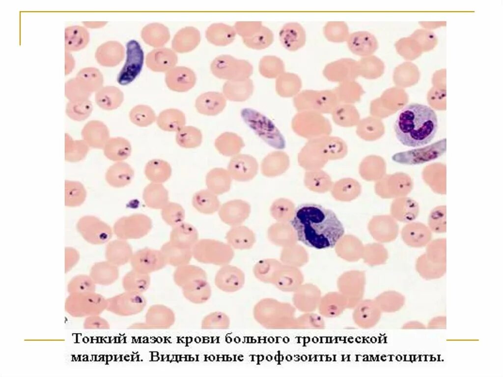 Изменения свойств эритроцитов при тропической малярии проявляются. Плазмодий Vivax. Малярийный плазмодий. Малярийный плазмодий в толстой капле. Plasmodium Vivax морфология.