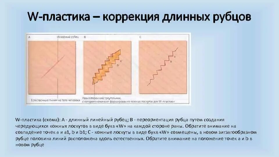 Освобождение от рубцов латынь