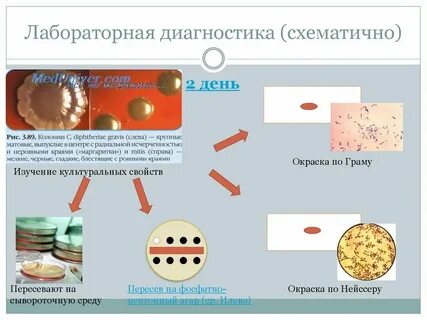 Диагностика дифтерии