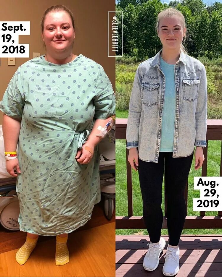 Метаболическая таблица продуктов с баллами. Метаболическая диета таблица продуктов. Гормоны для похудения. Как похудеть после гормонов. Похудение до и после фото.