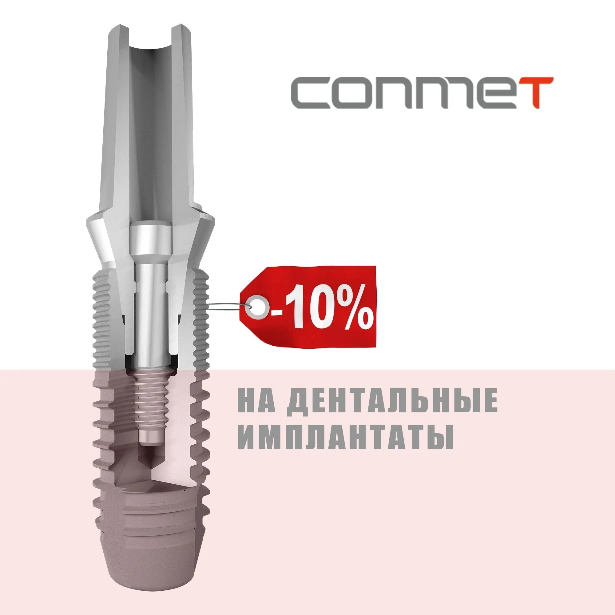 ооо конмет. конмет ортодонтические импланты. мини имплантаты конмет. заглушка импланта. конмет имплантаты.