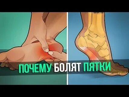 Почему утром болят стопы ног