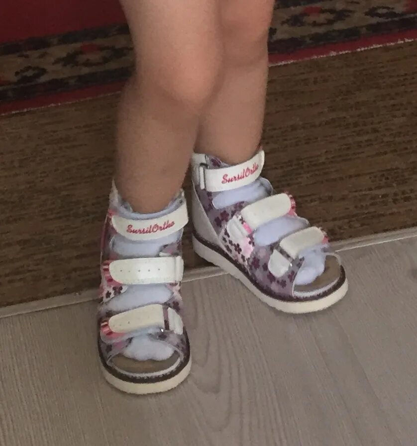Вальгус какую обувь. Ортопедическая обувь для детей при вальгусной деформации. Ортопедические сандали для детей при вальгусной деформации. Ортопедическая обувьваьгус дети. Обувь ортопедическая детская для вальгусной стопы.