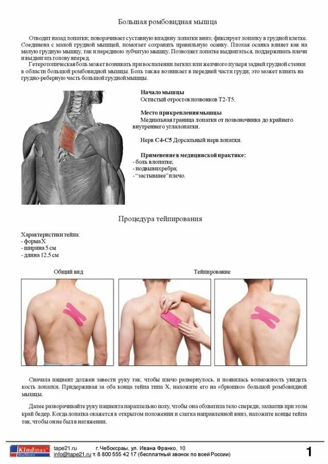 Почему может болеть лопатка. Болит ромбовидная мышца. Малая ромбовидная мышца спины болит. Спазм ромбовидной мышцы. Малая ромбовидная мышца болит причина.