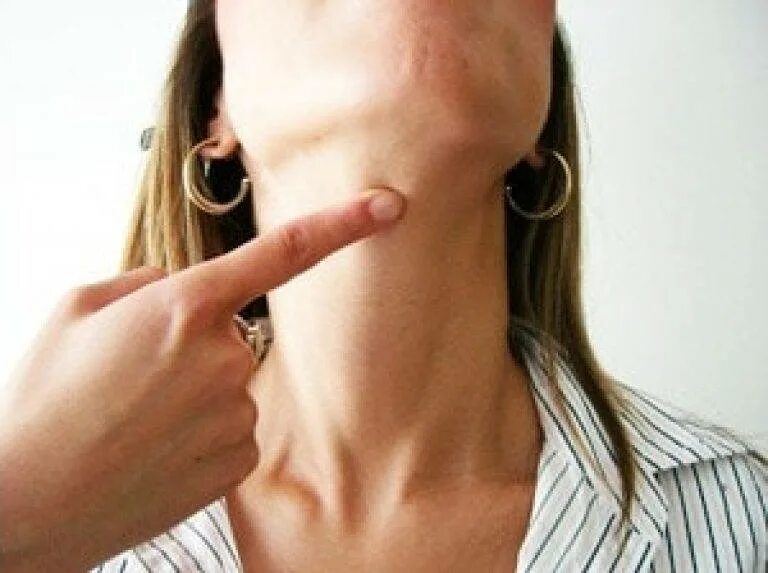 Твердое под подбородком. Твердое под подбородком. Лимфоузлы околоушные схема. Увеличенные лимфоузлы шеи. Подчелюстные лимфоузлы анатомия.