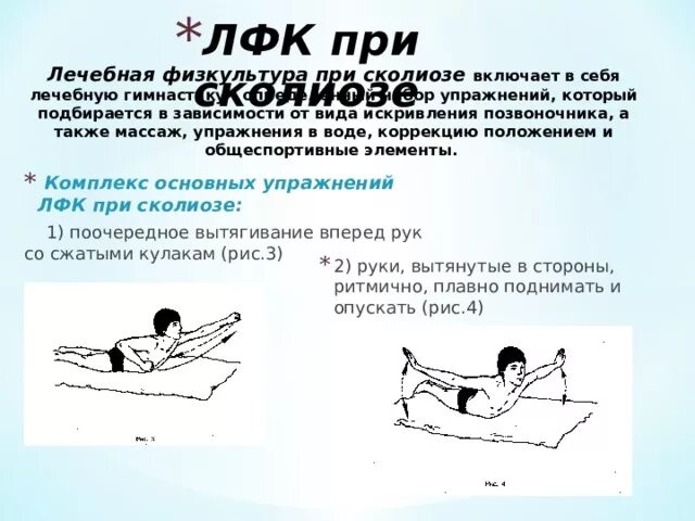 Лечебная физкультура при 1. Лечебная гимнастика при сколиозе 2 степени у подростков. Комплекс лечебной гимнастики 1 при инфаркте миокарда. Сколиоз лфк при сколиозе 2 степени. Лфк упражнения для спины при сколиозе 1 степени.