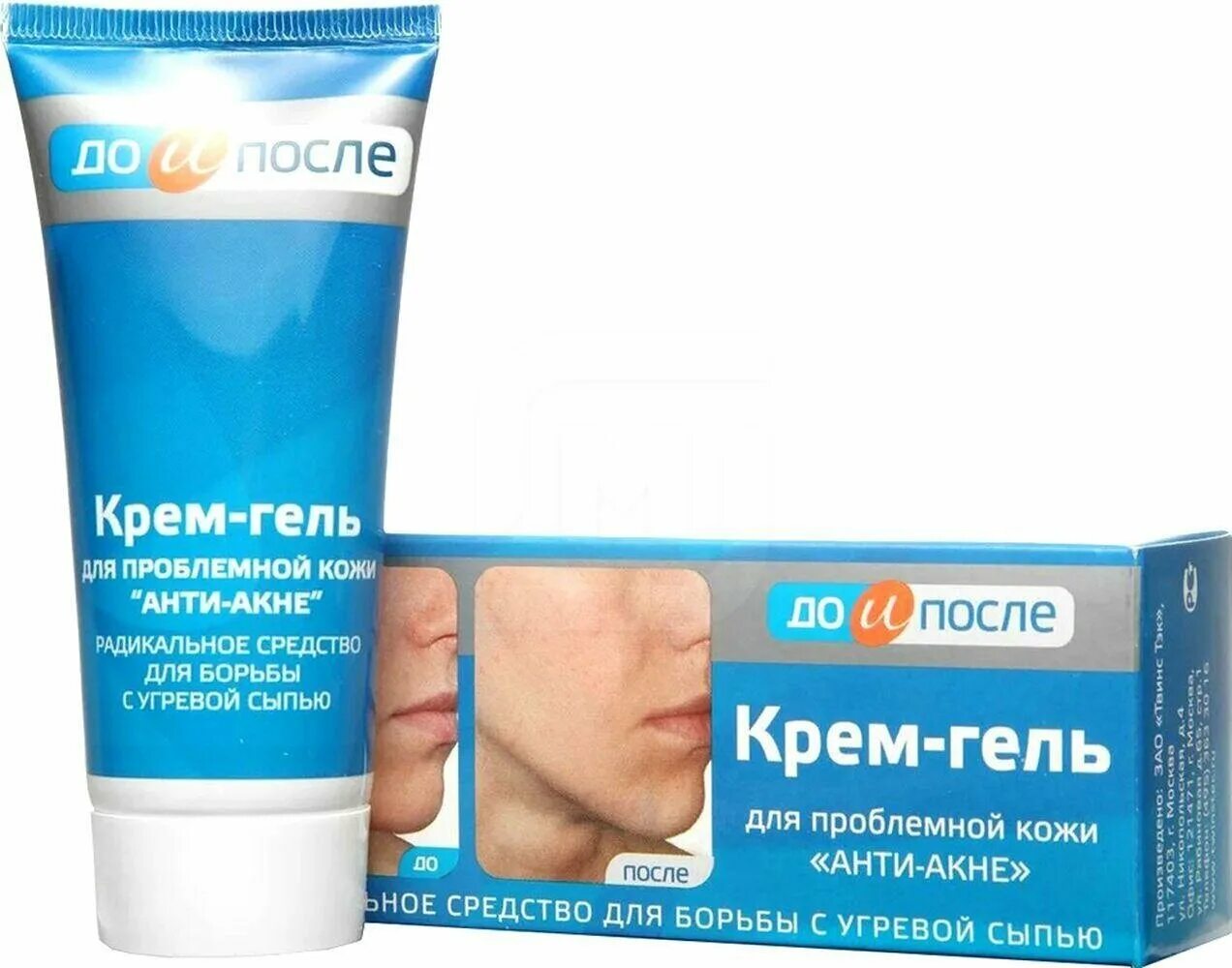 Анти-акне крем Anti-acne Cream. Гель анти акне 30мл sendo. Крем-гель д/проблемной кожи "анти-акне" 50мл. Крем до и после. Крем убирающий прыщи