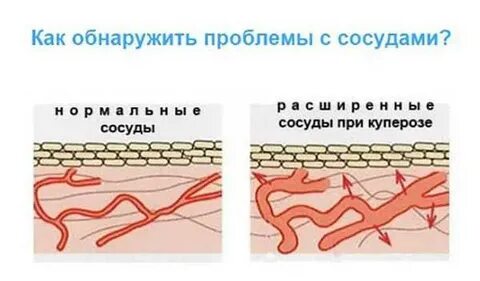 Кровеносные сосуды близко к поверхности кожи