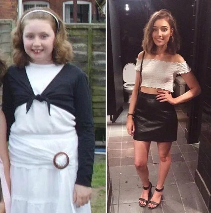 Некрасивая в детстве. Некрасивые люди которые стали красивыми. Раньше была некрасивая. Вера брежнева из гадкого утенка в красавицу. Дженнифер гарнер в детстве.