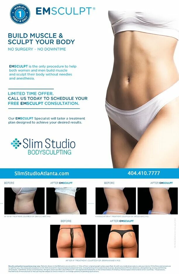 аппарат emsculpt для коррекции фигуры. Emsculpt отзывы. Emsculpt до и после. Emsculpt отзывы пациентов. аппарат ems body sculpt ghp 400 для.