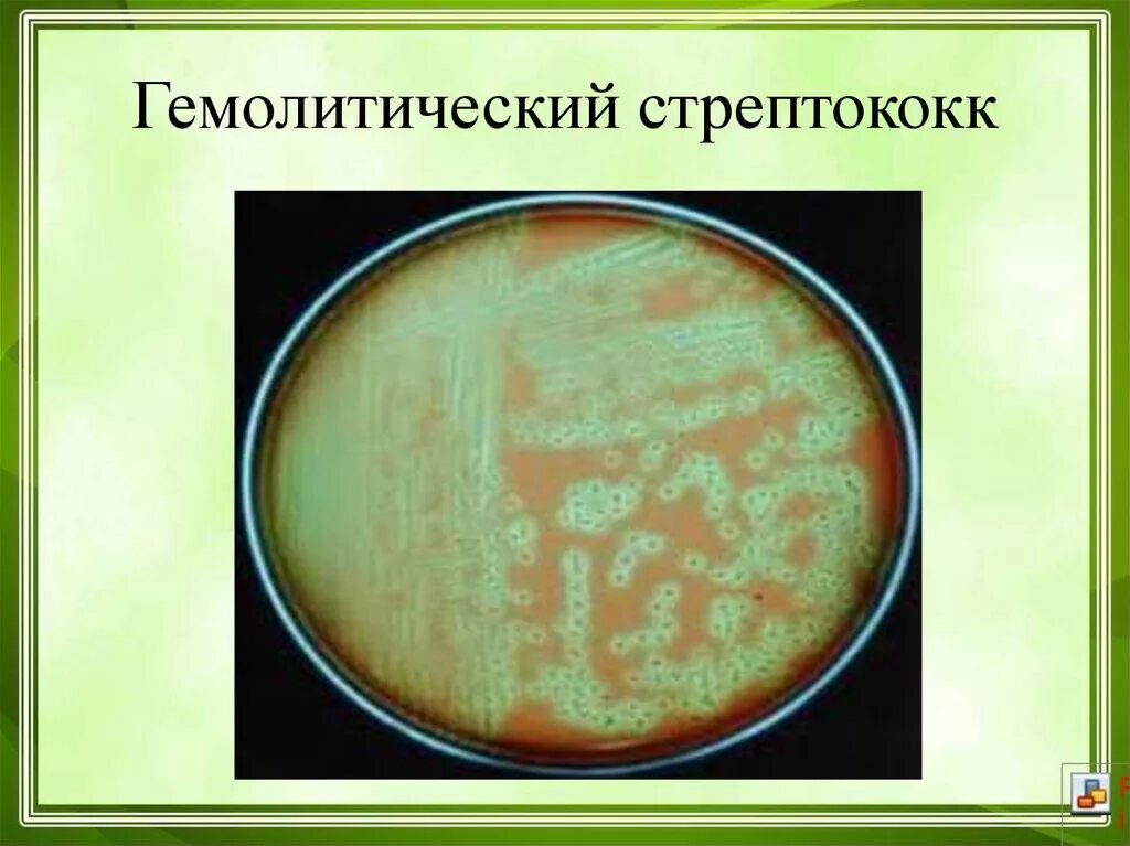 Бета гемолитический стрептококк заболевания. Бетта гемолитич стрептококк группы а. Этиология бета гемолитический стрептококк. Бета гемолитический стрептококк группы а. Β гемолитические стрептококки.