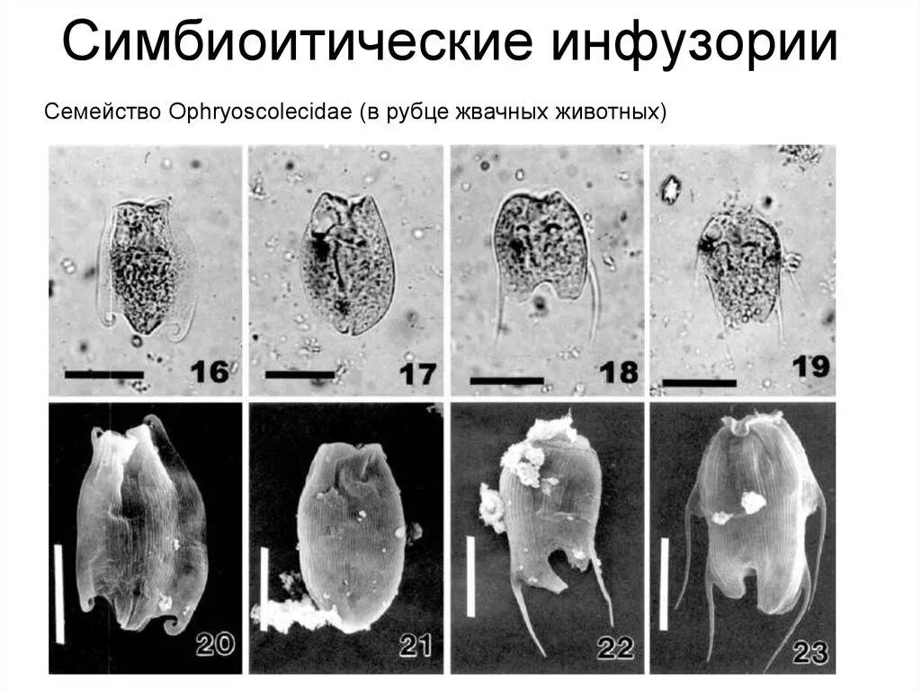 Бактерии рубца жвачных. Строение инфузории из рубца жвачных. микроорганизмы рубца. микроорганизмы в рубце жвачных. простейшие рубца жвачных.