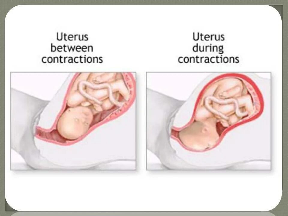 Как отличить тонус. Тонус матки у беременных. Тонус матки при беременности. Тонус второй триместр. Гипертонус беременной.