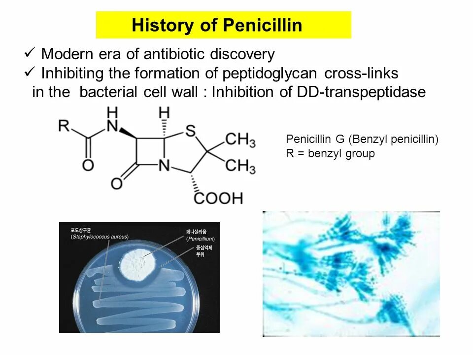 Пенициллин 10. Penicillin Discovery. Пенициллин связывающий протеин. Penicillin classification. Пенициллин формула химическая.