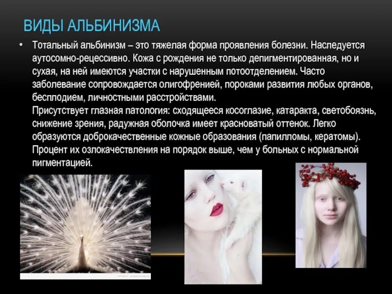 Альбинизм у человека рецессивный. Аутосомно-рецессивный тип наследования альбинизма. Альбинизм тип наследования причина. Альбинизм рецессивный. Альбинизм задачи по генетике.