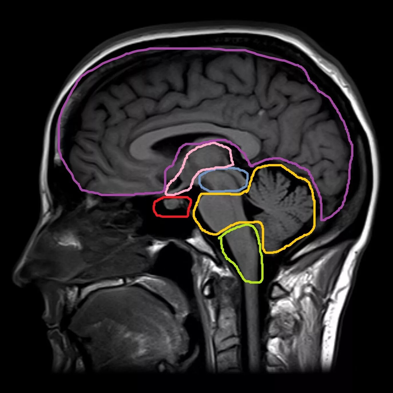 В мозгу есть область. Анатомия мозжечка на кт. Сагиттальный срез мрт. Таламус и гипоталамус на мрт. Мрт головного мозга аксиальный срез.