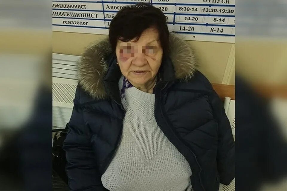 Бабушка в разбитой больнице. Ибрагимова 37 бабка разбилась фото.