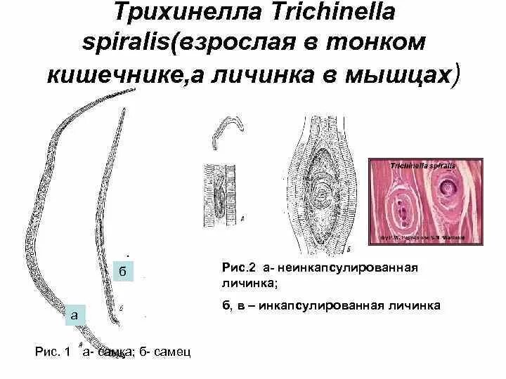 Трихинелла латынь. Трихинелла спиралис спиралис. Трихина строение. Личинки трихинеллы строение. Трихинелла латынь.