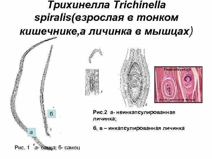 Трихинелла Спиралис морфология. Трихинелла половозрелая особь. Инкапсулированная личинка трихинеллы. Трихинелла Спиралис личинки.