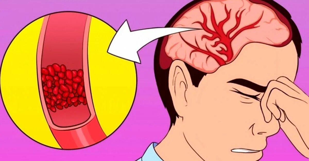 девушка головная боль. кружится голова внутри головы. головокружение при неврозе симптомы. головная боль мужчина. кружится голова внутри головы.