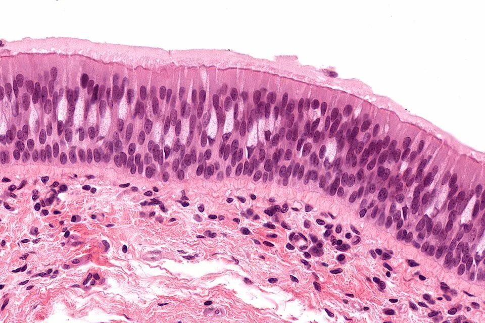 Нексус это гистология. Histology guide гистология. epithelial tissue histology. трахея гистология.