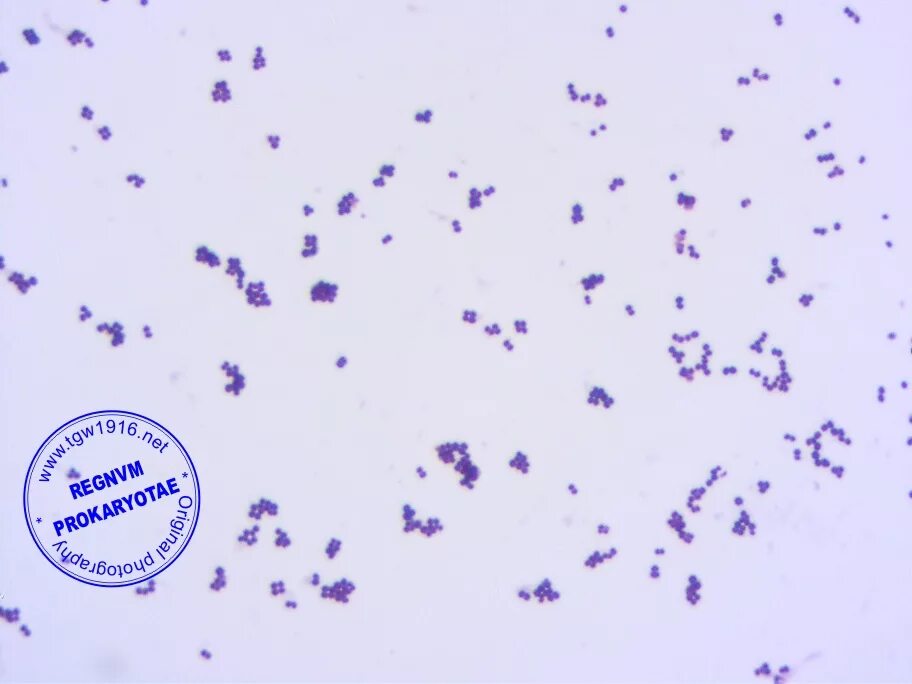 Staphylococcus aureus 5. Staphylococcus capitis. Macrococcus caseolyticus. Staphylococcus pasteuri. Staphylococcus cohnii.