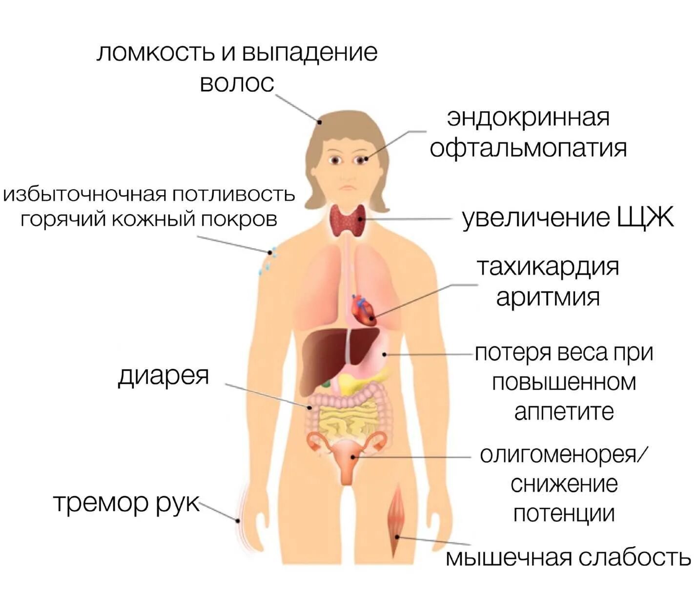 Заболевание диффузный зоб. Диффузно-токсический зоб (болезнь грейвса)педиатрия. эндокринная система базедова болезнь. болезни желез внутренней секреции вызванные. диффузный токсический зоб клиническая картина.