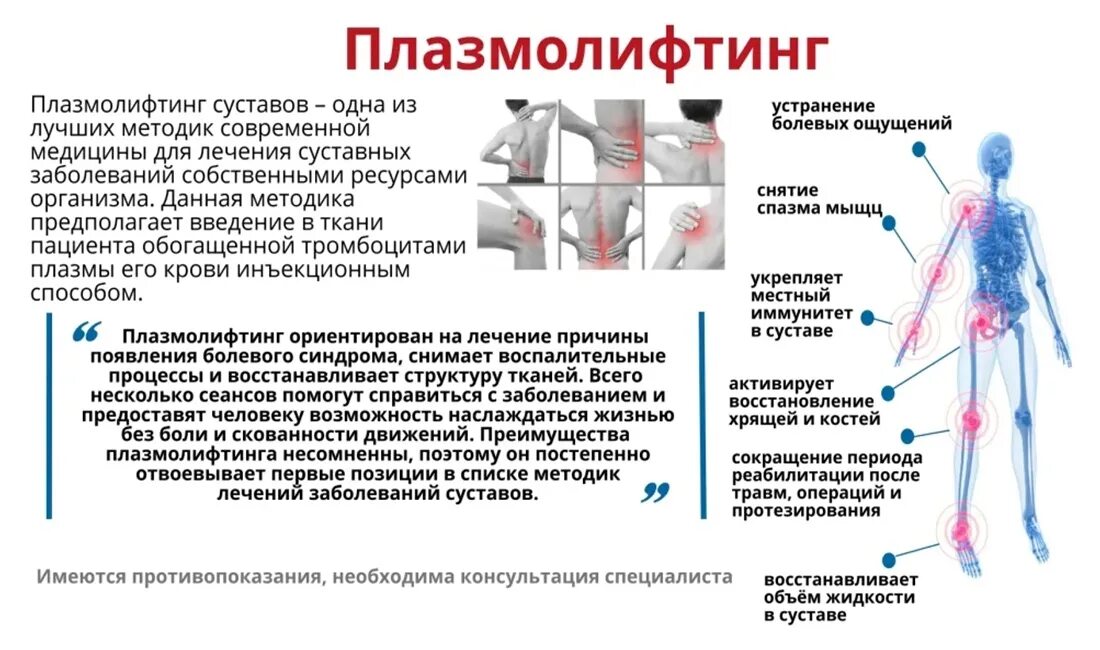 Плазмолифтинг коленного сустава. Плазмолифтинг для суставов противопоказания. Плазмолифтинг позвоночника. Плазмолифтинг суставов что это