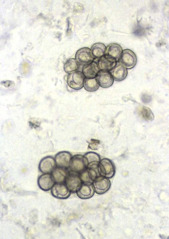 Dipylidium caninum. Огуречный цепень дипилидиоз.