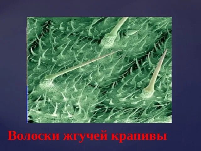 Строение волоска крапивы. Трихомы крапивы под микроскопом. Волоски крапивы под микроскопом. Клетка крапивы под микроскопом. Крапива в микроскопе.