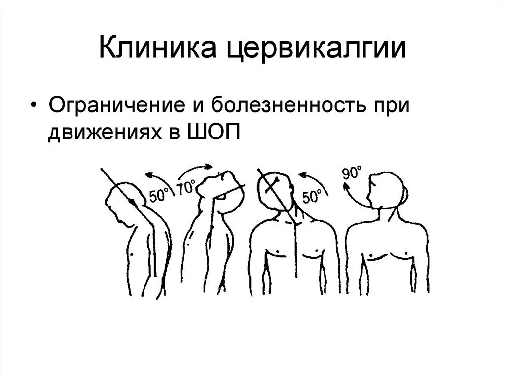 Цервикалгия что это такое. Цервикалгия шейного отдела диагноз. цервикалгия шейного отдела позвоночника что это такое. синдром цервикалгии шейный отдел. цервикалгия это шейный остеохондроз.