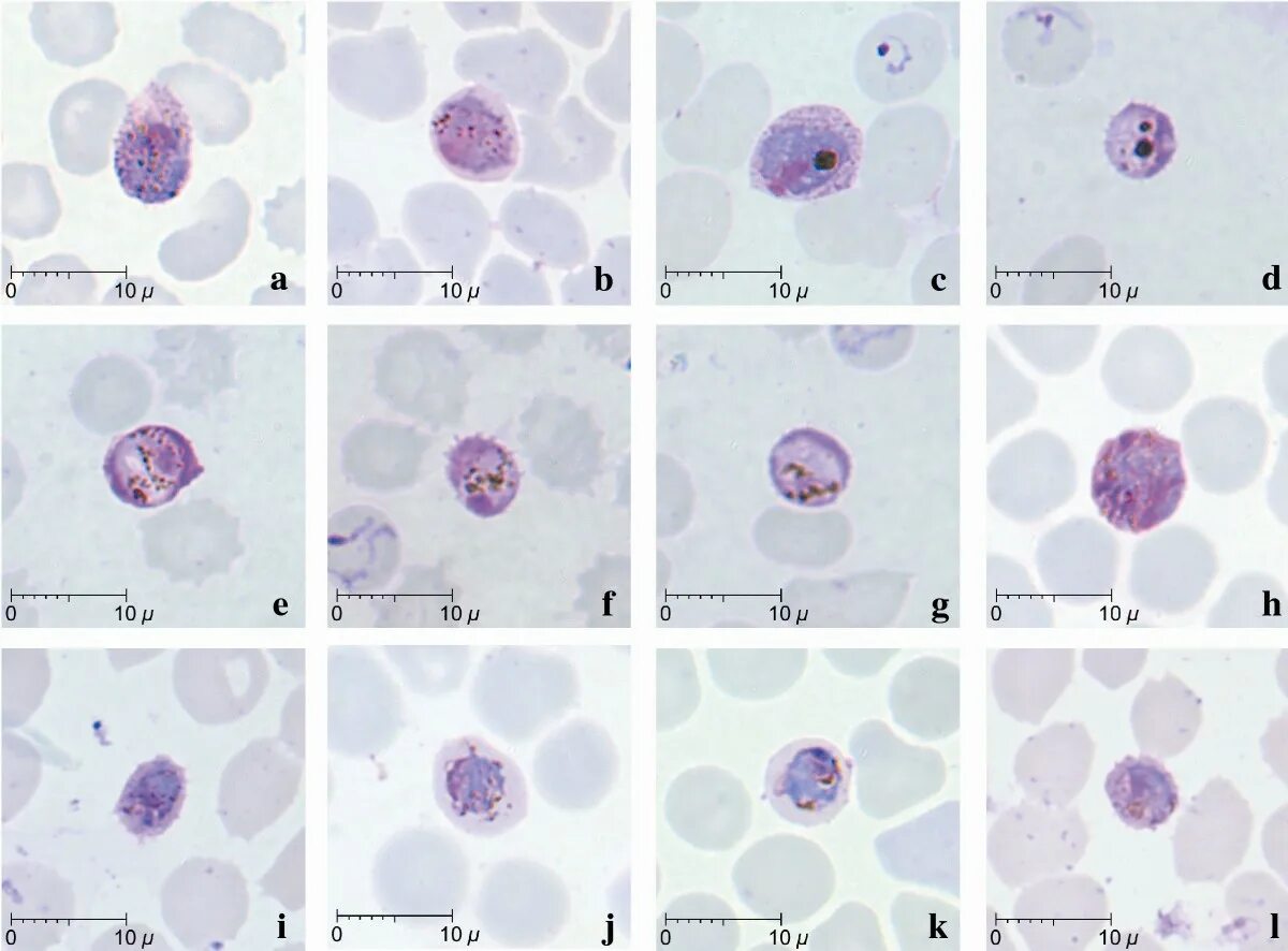 Стадии развития p falciparum обнаруживаемые при микроскопии. Plasmodium falciparum шизонт. plasmodium knowlesi. плазмодий вивакс. plasmodium falciparum трофозоит.