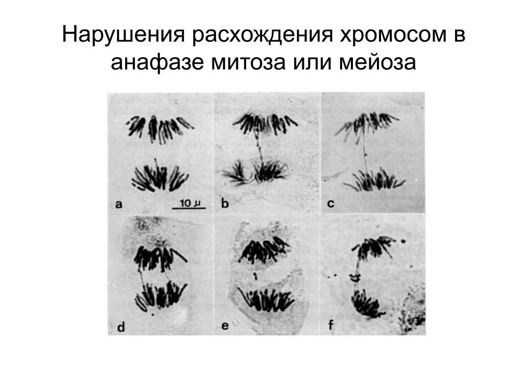 Нарушения при расхождении хромосом