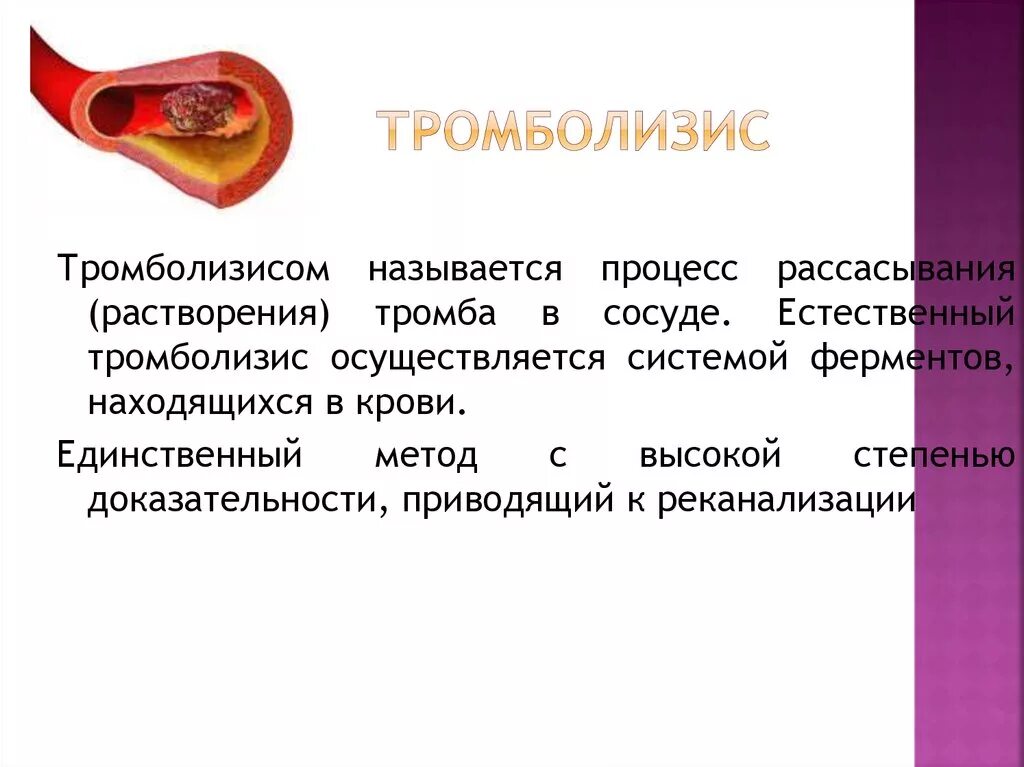 Как растворить тромб. Тромболизис. Процесс рассасывания тромба.