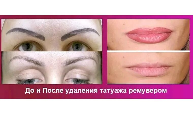 Чем отличается татуаж от перманентного