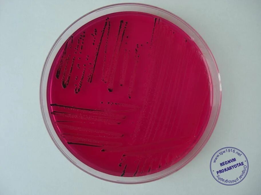 Spp salmonella spp shigella spp. Сальмонеллы на агаре плоскирева. сальмонелла на xld. агар xld shigella. сальмонелла на xld агаре.