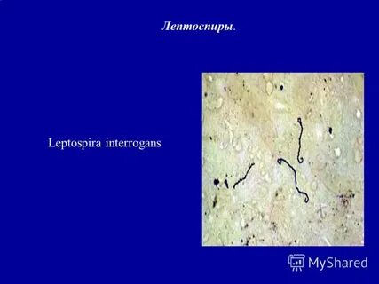 Лептоспиры