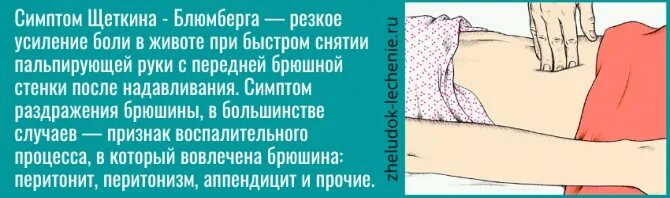 Симптом щеткина блюмберга это. Симптом Щеткина Блюмберга. Симптом Щёткина -Блюмберга это. Симптом Шиткина ломбера. Симптом Зеткина Блюм.ерга.